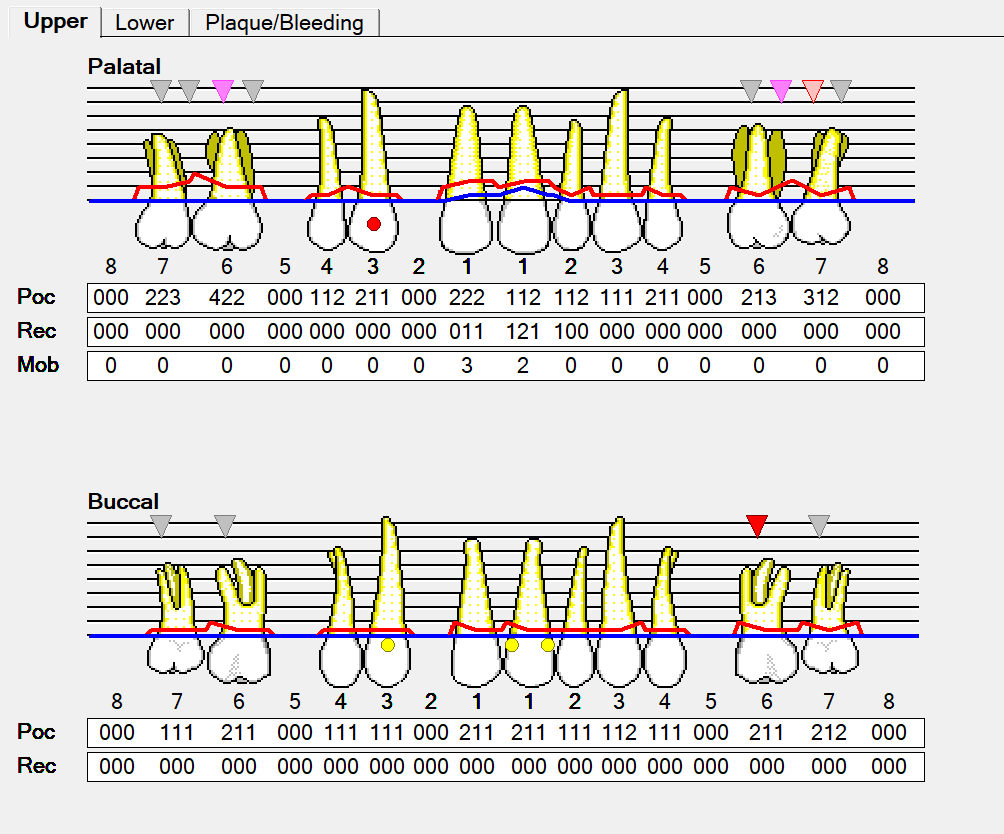 Printable Perio Chart
