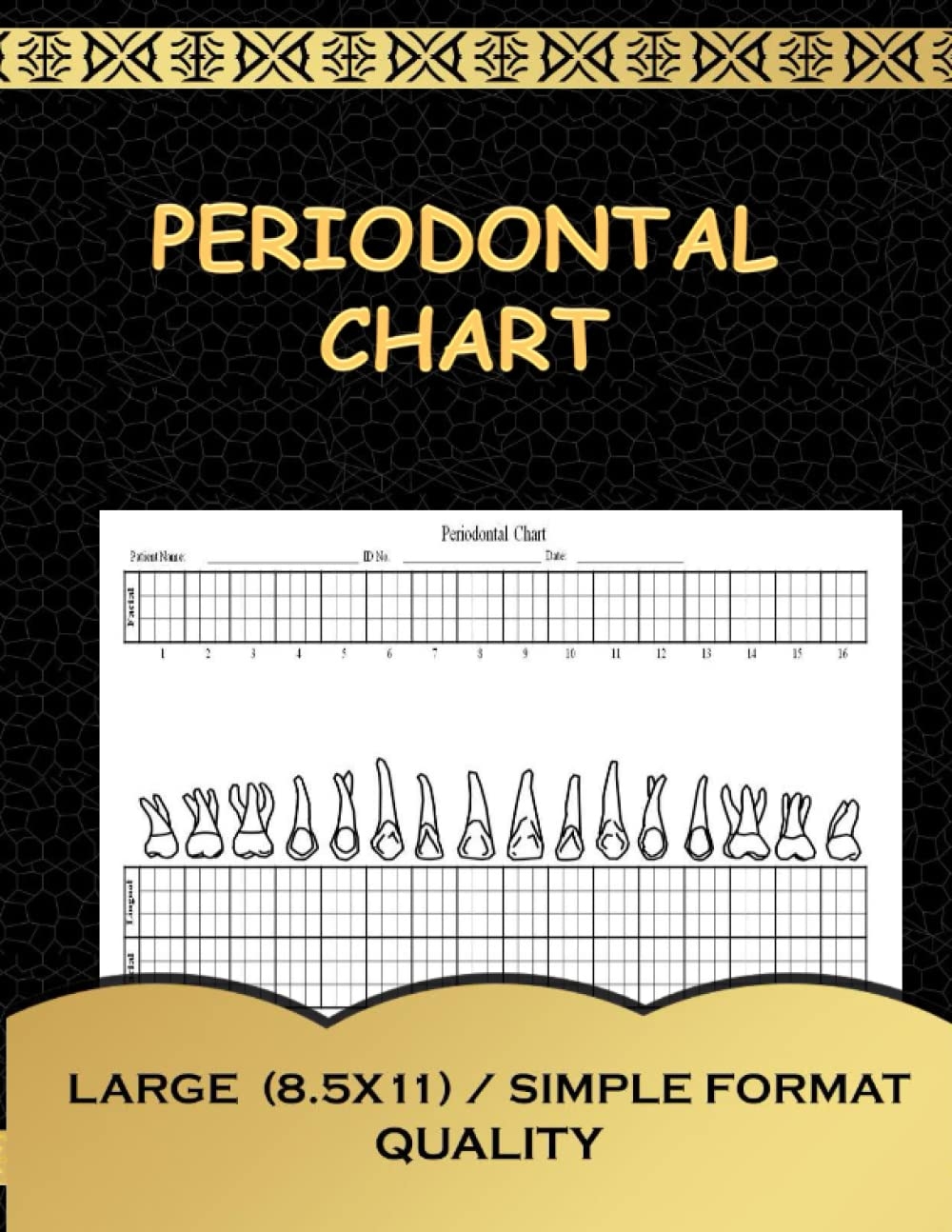 Periodontal Chart This Periodontal Chart Allows Dentists To Mark Irregularities On All 32 Teeth For Adult Patients Including The Facial And Lingual 