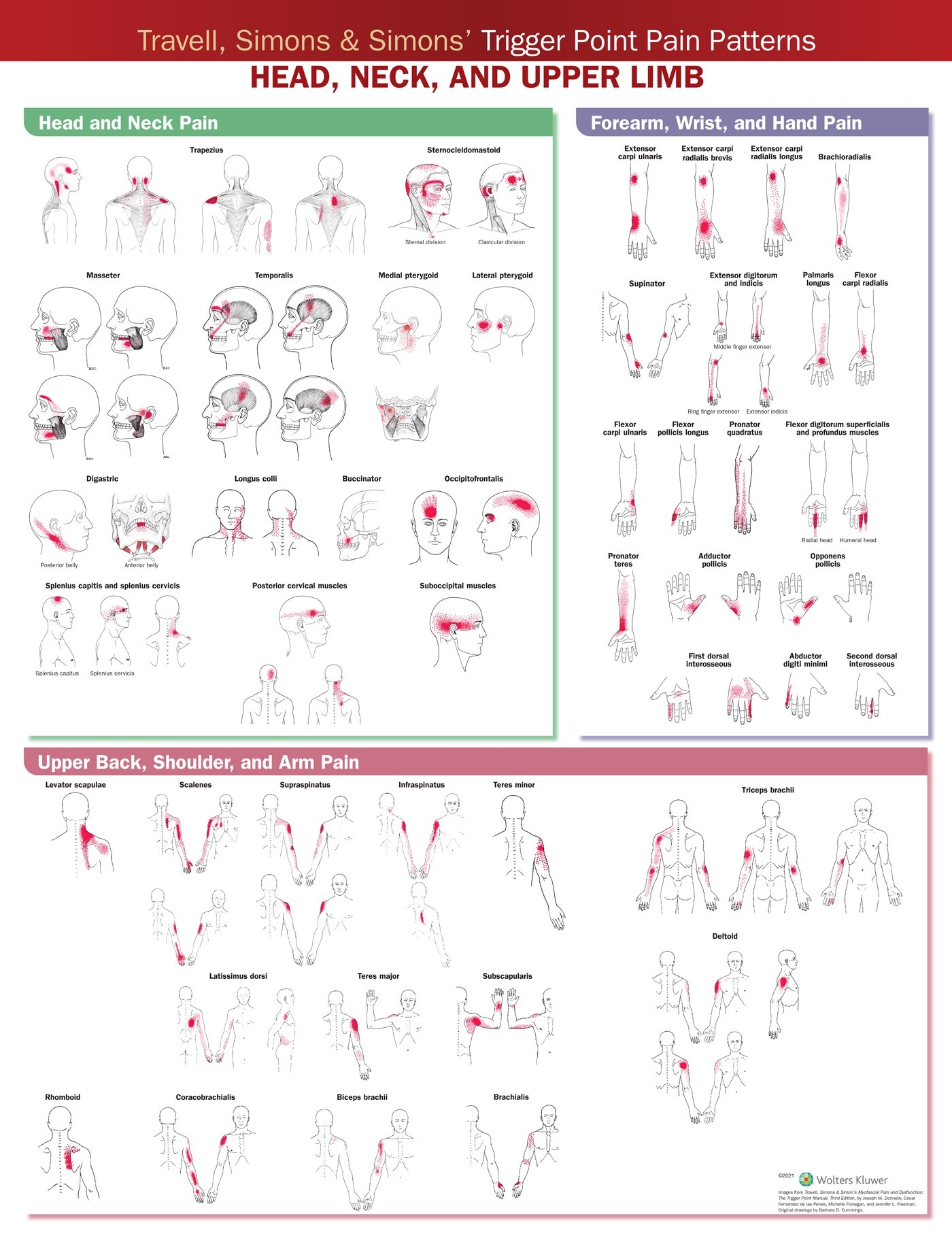 Travell Simons U0026 Simons Trigger Point Pain Patterns Wall Chart Head Neck And Upper Limb Soft Laminate Australian Physiotherapy Equipment