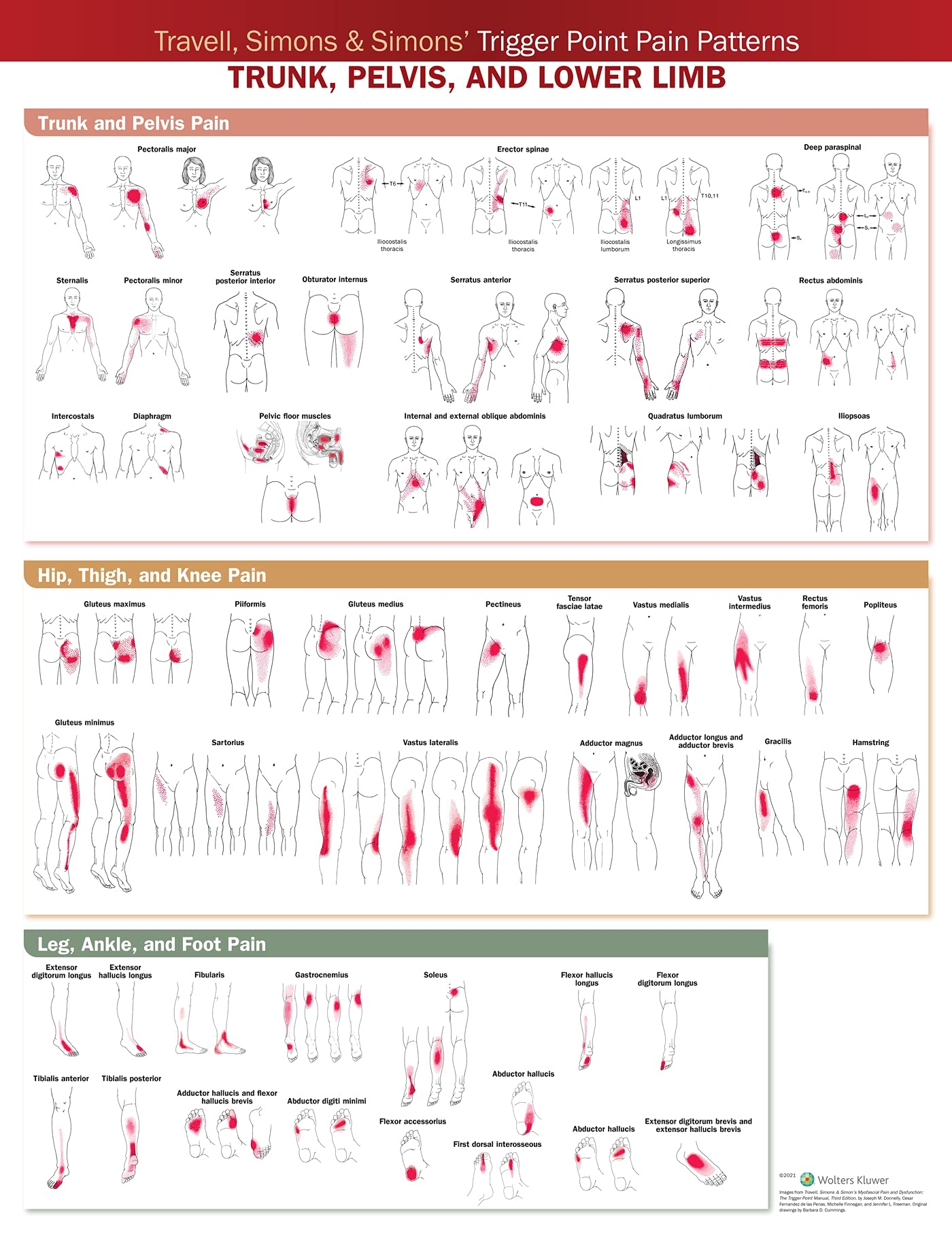 Travell Simons U0026 Simons Trigger Point Pain Patterns Wall Chart Trunk Pelvis And Lower Limb Anatomica Chart Company 9781975183851 Amazon au Books