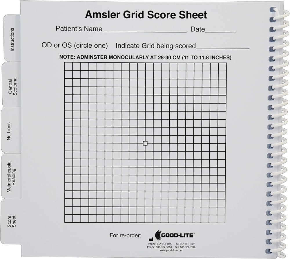 Amsler Grid Chart Printable