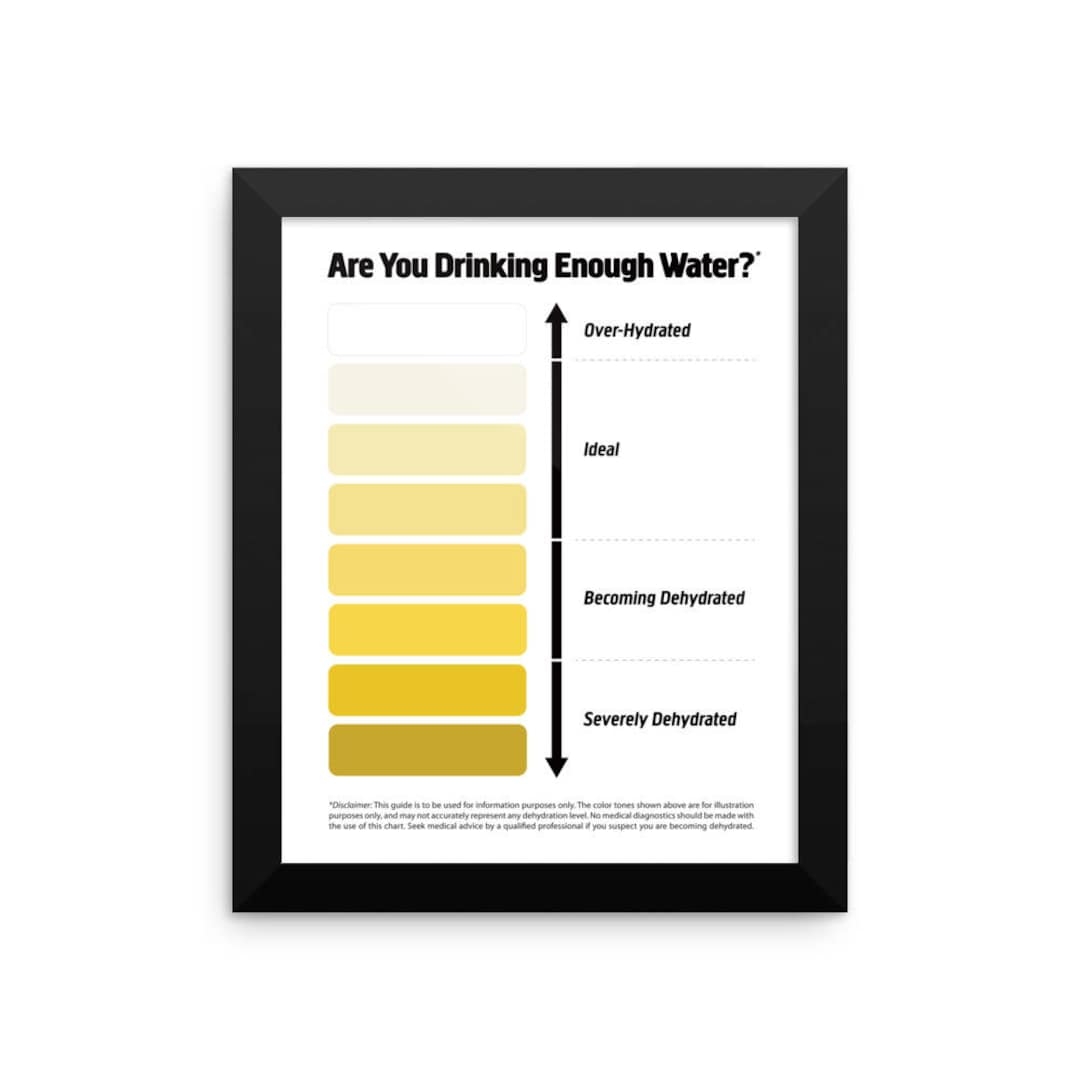 Buy Framed Urine Color Chart Pee Color Chart Water Intake Chart 