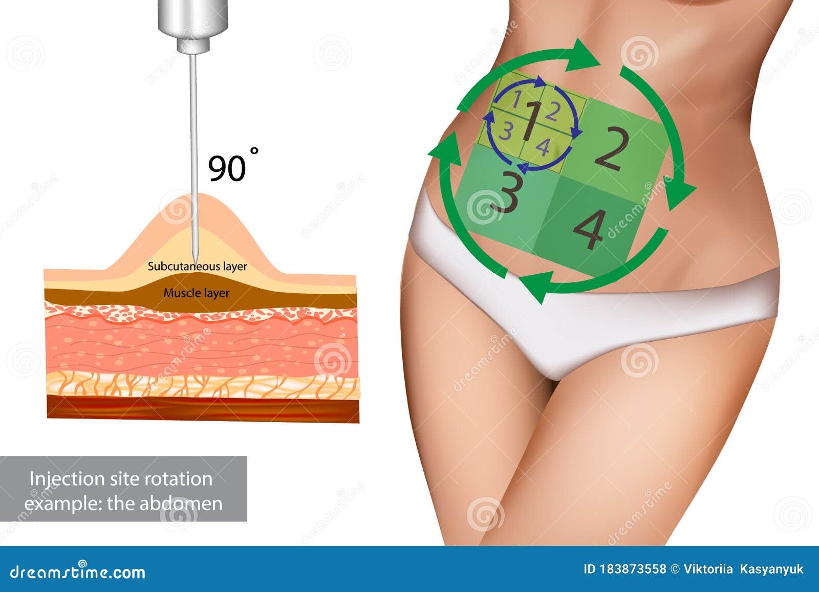 Injection Site Rotation Example The Abdomen Stock Vector Illustration Of Injections Medical 183873558