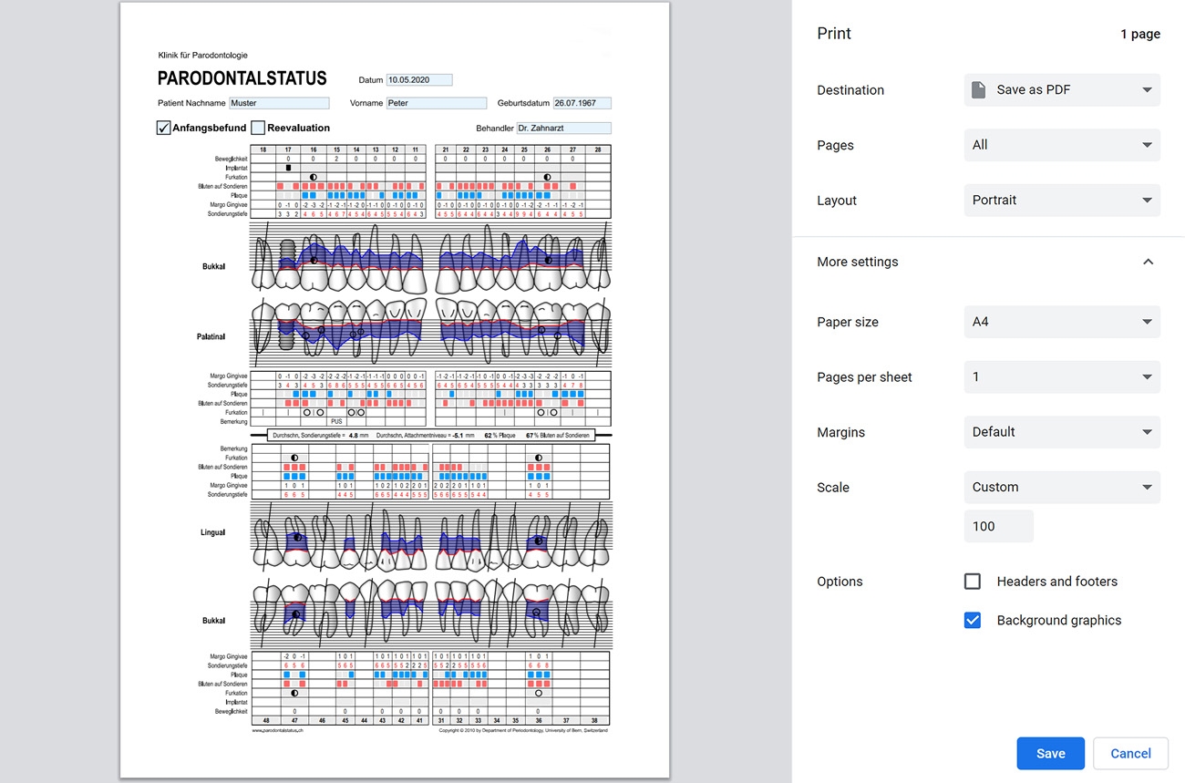 Free Printable Periodontal Chart