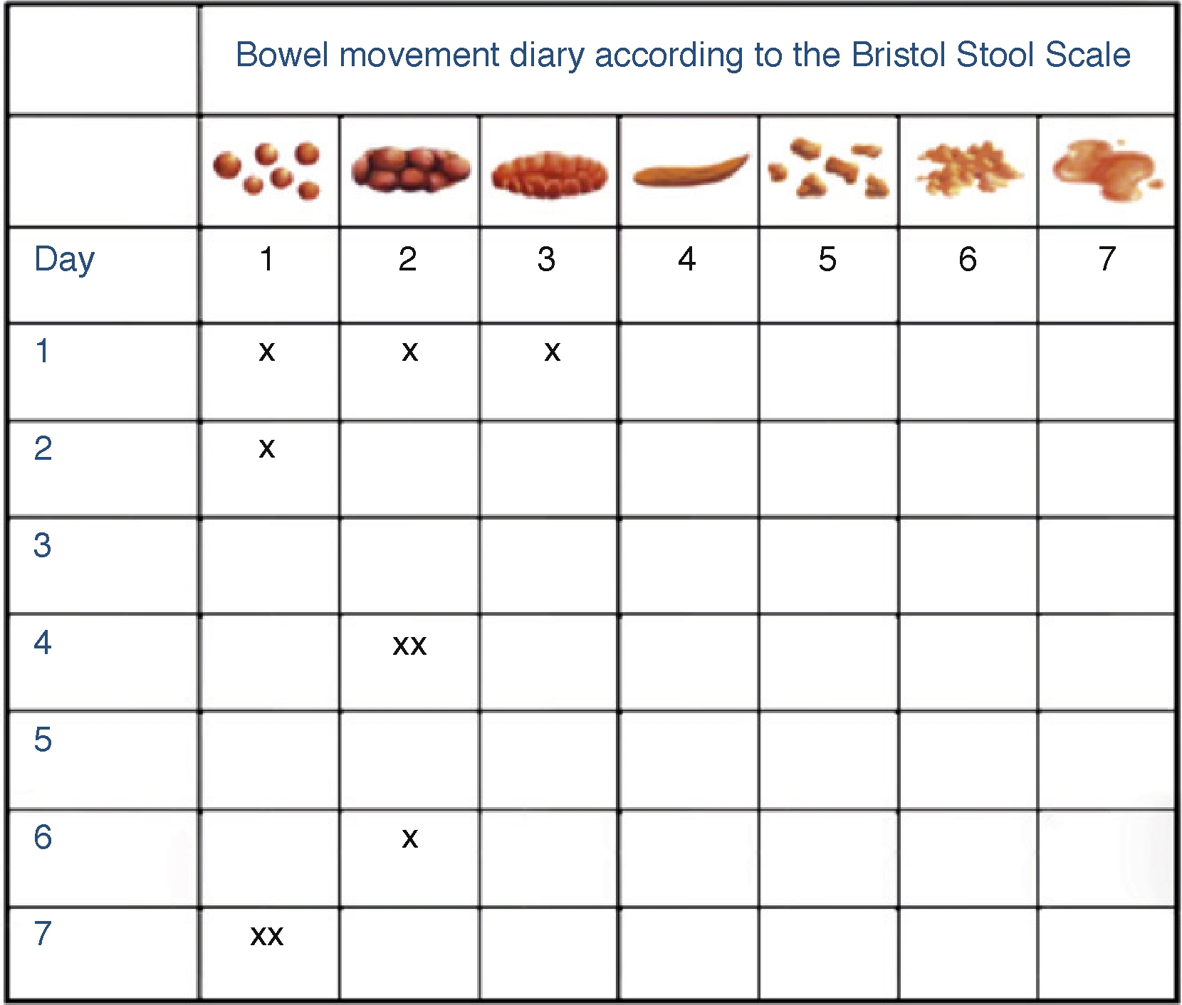 Polar Vectors As A Method For Evaluating The Effectiveness Of Irritable Bowel Syndrome Treatments An Analysis With Pinaverium Bromide 100 Mg Plus Simethicone 300 Mg Po Bid Revista De Gastroenterolog a De