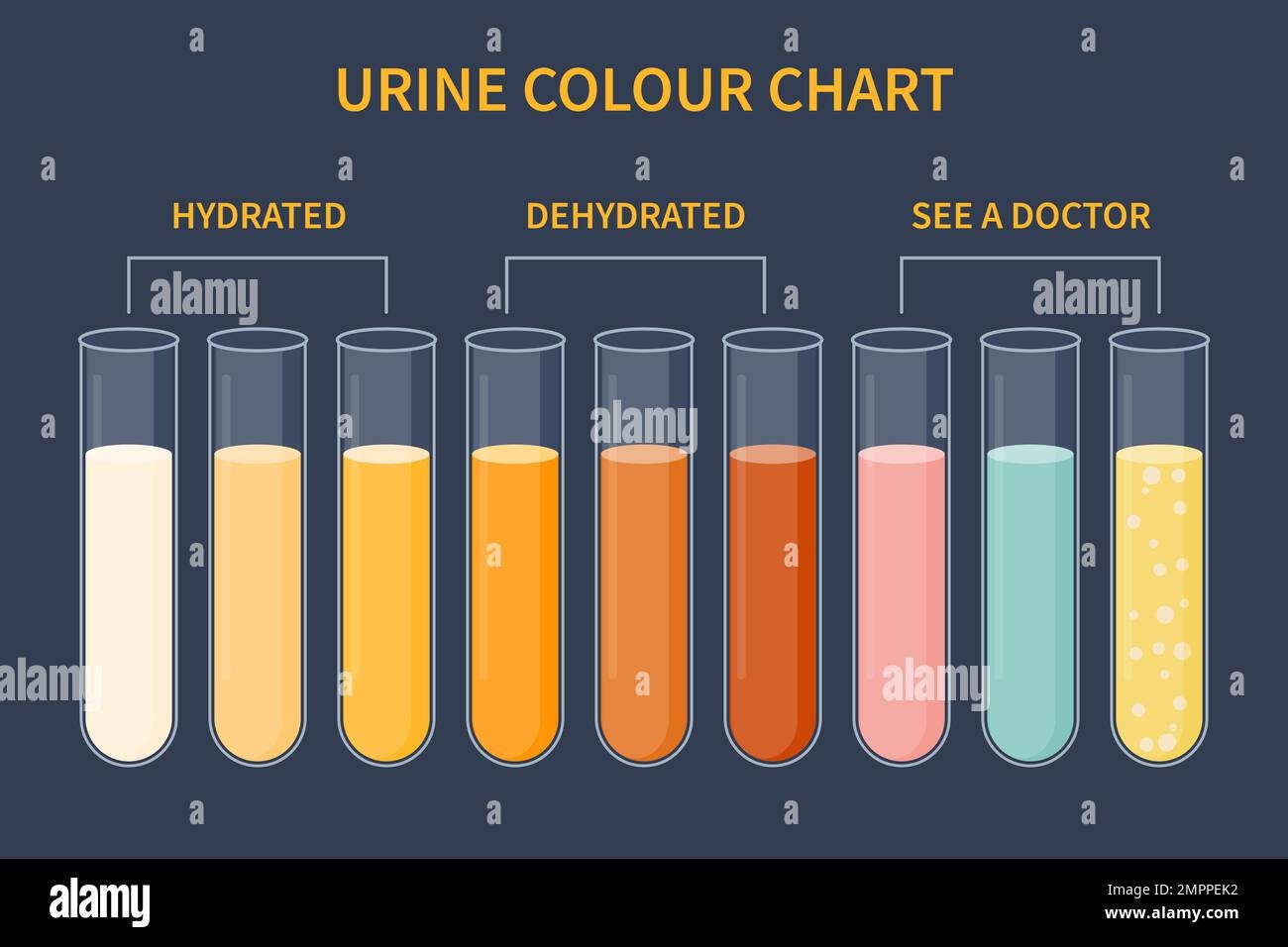 Urine Color Chart Illustration Of Dehydration Level Stock Vector Image Art Alamy