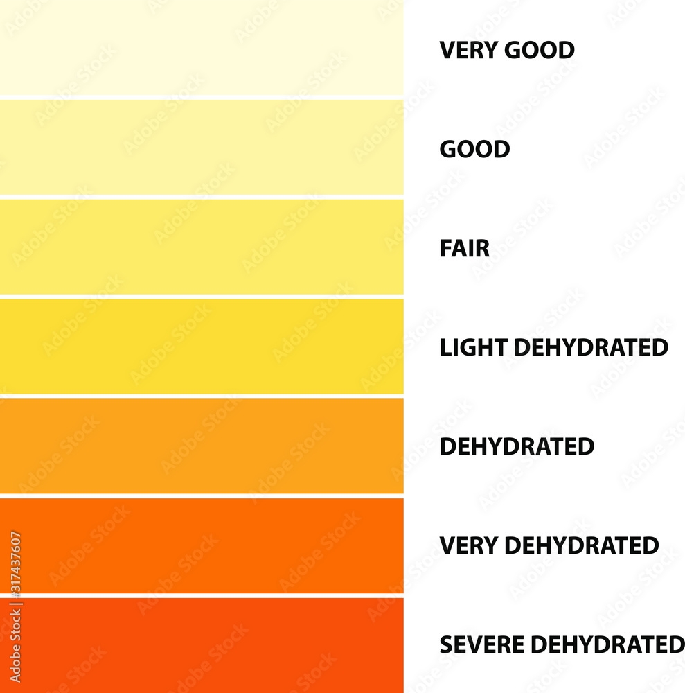 Urine Color Dehydration Urine Color Chart Vector Illustration Stock Vector Adobe Stock